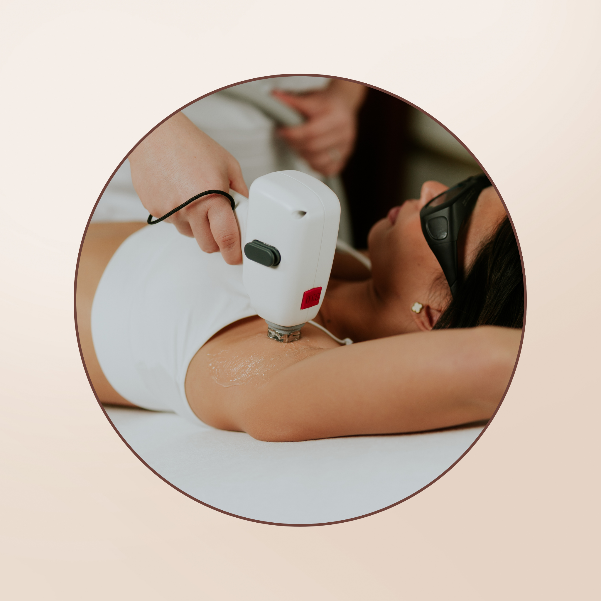 Epilation Durable (2)